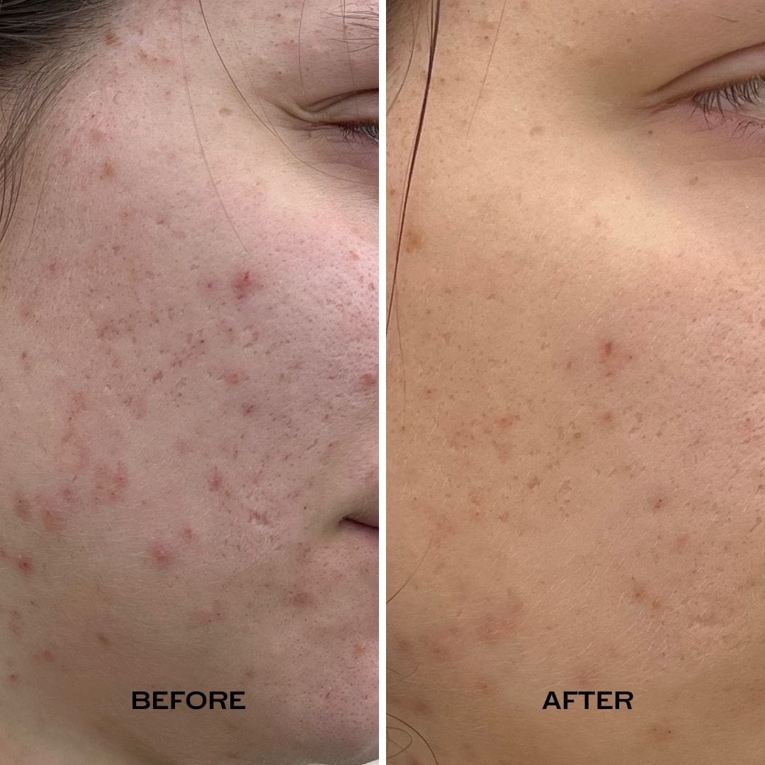 Luna Balancing Face Oil