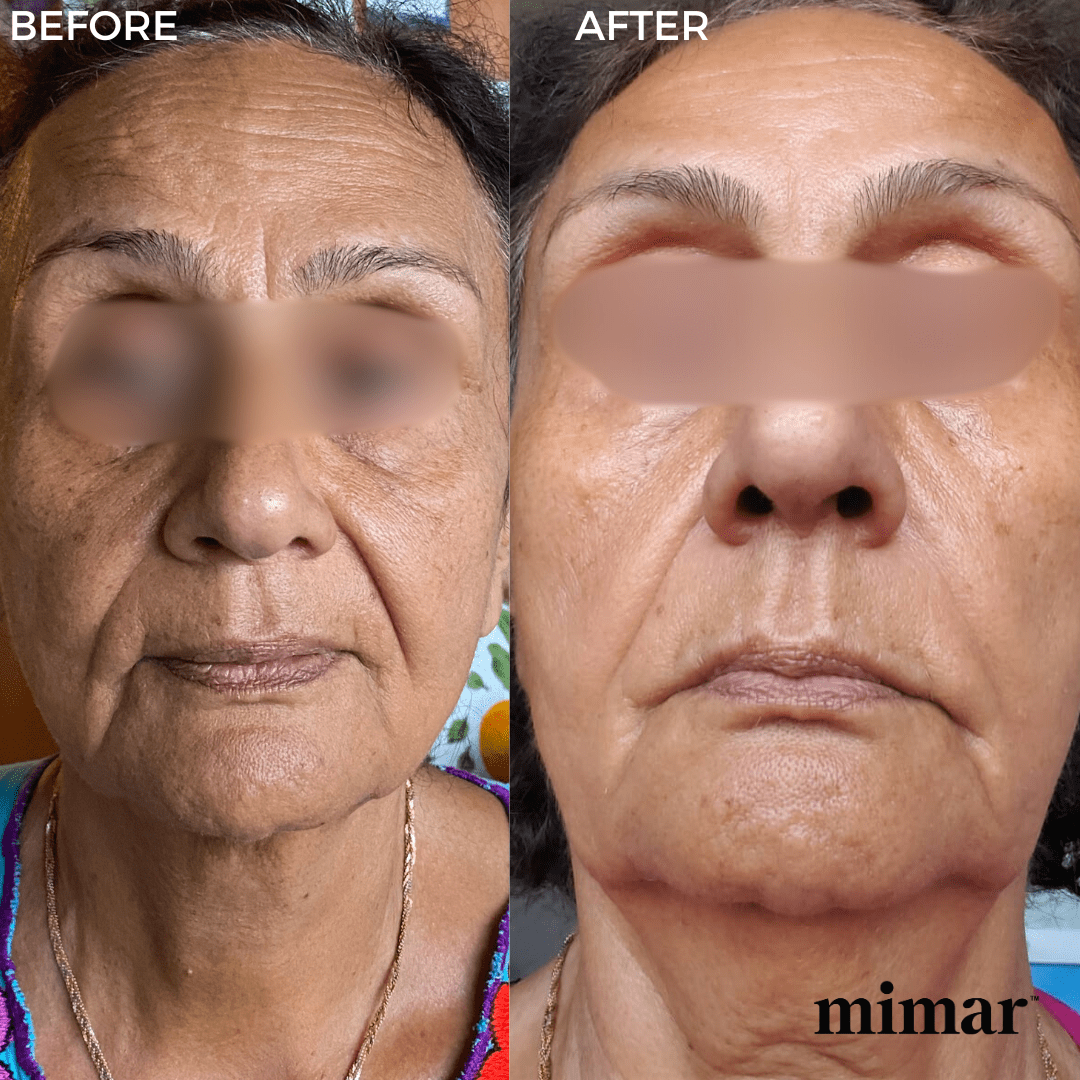 Ultimate Rejuvenation Set