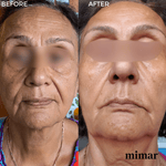 Ultimate Rejuvenation Set 5