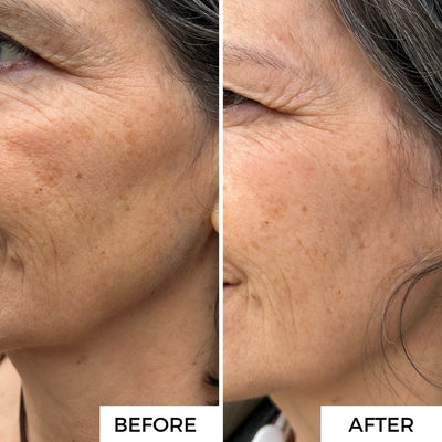 1. Reduces Fine Lines