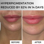Ultra Vit C Concentrate - Step 1. 4