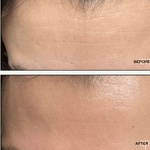 Ultimate Rejuvenation Set 3