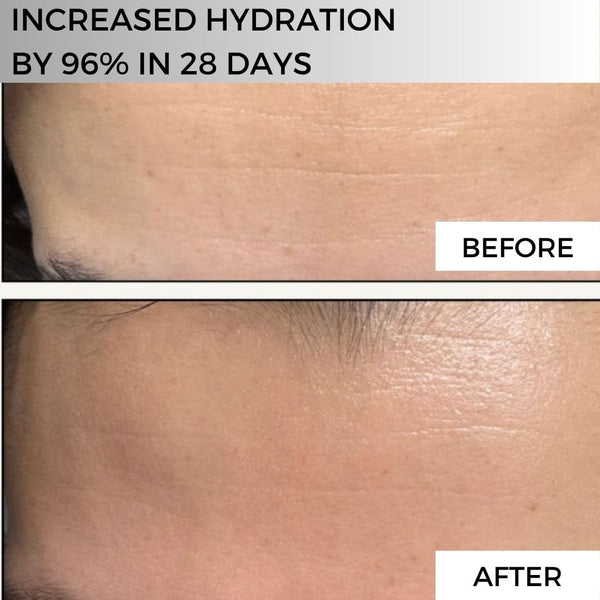 Ultra Hydrating Serum - Step 2.