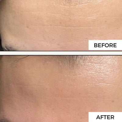 1. Reduces Fine Lines