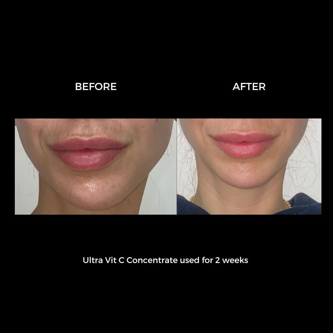 Ultimate Rejuvenation Set