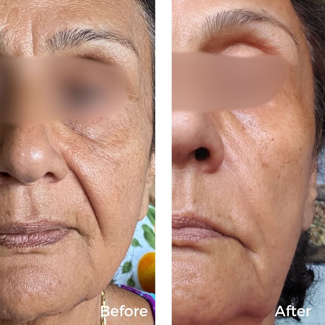 Sea buckthorn, açaí and jojoba, the botanical oils in Mimar Ultra Vit C Concentrate