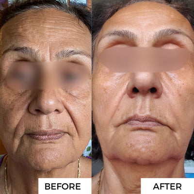 3. Fades Sun Spots